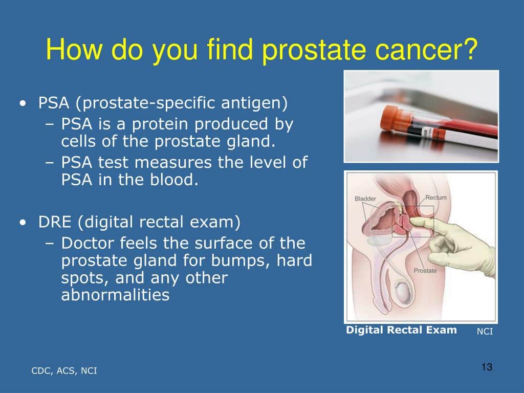 How Do They Check Prostate Cancer Brittany Roy S Blog